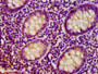 IHC image of CAC13349 diluted at 1:400 and staining in paraffin-embedded human appendix tissue performed on a Leica BondTM system. After dewaxing and hydration, antigen retrieval was mediated by high pressure in a citrate buffer (pH 6.0). Section was blocked with 10% normal goat serum 30min at RT. Then primary antibody (1% BSA) was incubated at 4°C overnight. The primary is detected by a biotinylated secondary antibody and visualized using an HRP conjugated SP system. IHC image of CAC13349 diluted at 1:400 and staining in paraffin-embedded human appendix tissue performed on a Leica BondTM system. After dewaxing and hydration, antigen retrieval was mediated by high pressure in a citrate buffer (pH 6.0). Section was blocked with 10% normal goat serum 30min at RT. Then primary antibody (1% BSA) was incubated at 4°C overnight. The primary is detected by a biotinylated secondary antibody and visualized using an HRP conjugated SP system.