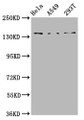 Western Blot, Positive WB detected in: Hela whole cell lysate, A549 whole cell lysate, 293T whole cell lysate, All lanes: CNGB1 antibody at 4.6ug/ml, Secondary, Goat polyclonal to rabbit IgG at 1/50000 dilution, Predicted band size: 140, 71, 33 kDa, Observed band size: 140 kDa Western Blot, Positive WB detected in: Hela whole cell lysate, A549 whole cell lysate, 293T whole cell lysate, All lanes: CNGB1 antibody at 4.6ug/ml, Secondary, Goat polyclonal to rabbit IgG at 1/50000 dilution, Predicted band size: 140, 71, 33 kDa, Observed band size: 140 kDa