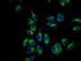 Immunofluorescence staining of A549 cells with CAC13355 at 1:66, counter-stained with DAPI. The cells were fixed in 4% formaldehyde, permeabilized using 0.2% Triton X-100 and blocked in 10% normal Goat Serum. The cells were then incubated with the antibody overnight at 4°C. The secondary antibody was Alexa Fluor 488-congugated AffiniPure Goat Anti-Rabbit IgG(H+L). Immunofluorescence staining of A549 cells with CAC13355 at 1:66, counter-stained with DAPI. The cells were fixed in 4% formaldehyde, permeabilized using 0.2% Triton X-100 and blocked in 10% normal Goat Serum. The cells were then incubated with the antibody overnight at 4°C. The secondary antibody was Alexa Fluor 488-congugated AffiniPure Goat Anti-Rabbit IgG(H+L).