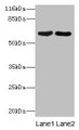 Western Blot, All lanes: CRMP1 antibody at 2ug/ml, Lane 1: Rat brain tissue, Lane 2: Mouse lung tissue, Secondary, Goat polyclonal to rabbit IgG at 1/10000 dilution, Predicted band size: 63, 75 kDa, Observed band size: 63 kDa Western Blot, All lanes: CRMP1 antibody at 2ug/ml, Lane 1: Rat brain tissue, Lane 2: Mouse lung tissue, Secondary, Goat polyclonal to rabbit IgG at 1/10000 dilution, Predicted band size: 63, 75 kDa, Observed band size: 63 kDa