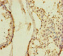 Immunohistochemistry of paraffin-embedded human testis tissue using CAC13358 at dilution of 1:100 Immunohistochemistry of paraffin-embedded human testis tissue using CAC13358 at dilution of 1:100