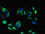 Immunofluorescent analysis of Hela cells using CAC13362 at dilution of 1:100 and Alexa Fluor 488-congugated AffiniPure Goat Anti-Rabbit IgG(H+L) Immunofluorescent analysis of Hela cells using CAC13362 at dilution of 1:100 and Alexa Fluor 488-congugated AffiniPure Goat Anti-Rabbit IgG(H+L)