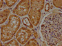 IHC image of CAC13365 diluted at 1:100 and staining in paraffin-embedded human kidney tissue performed on a Leica BondTM system. After dewaxing and hydration, antigen retrieval was mediated by high pressure in a citrate buffer (pH 6.0). Section was blocked with 10% normal goat serum 30min at RT. Then primary antibody (1% BSA) was incubated at 4°C overnight. The primary is detected by a biotinylated secondary antibody and visualized using an HRP conjugated SP system. IHC image of CAC13365 diluted at 1:100 and staining in paraffin-embedded human kidney tissue performed on a Leica BondTM system. After dewaxing and hydration, antigen retrieval was mediated by high pressure in a citrate buffer (pH 6.0). Section was blocked with 10% normal goat serum 30min at RT. Then primary antibody (1% BSA) was incubated at 4°C overnight. The primary is detected by a biotinylated secondary antibody and visualized using an HRP conjugated SP system.