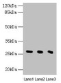 Western Blot, All lanes: Nqo2 antibody at 8ug/ml, Lane 1: Rat heart tissue, Lane 2: Mouse liver tissue, Lane 3: Mouse kidney tissue, Secondary, Goat polyclonal to rabbit IgG at 1/10000 dilution, Predicted band size: 27 kDa, Observed band size: 27 kDa Western Blot, All lanes: Nqo2 antibody at 8ug/ml, Lane 1: Rat heart tissue, Lane 2: Mouse liver tissue, Lane 3: Mouse kidney tissue, Secondary, Goat polyclonal to rabbit IgG at 1/10000 dilution, Predicted band size: 27 kDa, Observed band size: 27 kDa