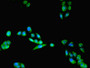 Immunofluorescent analysis of PC-3 cells using CAC13373 at dilution of 1:100 and Alexa Fluor 488-congugated AffiniPure Goat Anti-Rabbit IgG(H+L) Immunofluorescent analysis of PC-3 cells using CAC13373 at dilution of 1:100 and Alexa Fluor 488-congugated AffiniPure Goat Anti-Rabbit IgG(H+L)