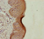 Immunohistochemistry of paraffin-embedded human skin tissue using CAC13384 at dilution of 1:100 Immunohistochemistry of paraffin-embedded human skin tissue using CAC13384 at dilution of 1:100