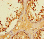 Immunohistochemistry of paraffin-embedded human testis tissue using CAC13385 at dilution of 1:100 Immunohistochemistry of paraffin-embedded human testis tissue using CAC13385 at dilution of 1:100