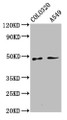 Western Blot, Positive WB detected in: Colo320 whole cell lysate, A549 whole cell lysate, All lanes: PNPLA5 antibody at 3.1ug/ml, Secondary, Goat polyclonal to rabbit IgG at 1/50000 dilution, Predicted band size: 48, 36 kDa, Observed band size: 48 kDa Western Blot, Positive WB detected in: Colo320 whole cell lysate, A549 whole cell lysate, All lanes: PNPLA5 antibody at 3.1ug/ml, Secondary, Goat polyclonal to rabbit IgG at 1/50000 dilution, Predicted band size: 48, 36 kDa, Observed band size: 48 kDa