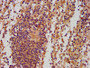 IHC image of CAC13391 diluted at 1:500 and staining in paraffin-embedded human spleen tissue performed on a Leica BondTM system. After dewaxing and hydration, antigen retrieval was mediated by high pressure in a citrate buffer (pH 6.0). Section was blocked with 10% normal goat serum 30min at RT. Then primary antibody (1% BSA) was incubated at 4°C overnight. The primary is detected by a biotinylated secondary antibody and visualized using an HRP conjugated SP system. IHC image of CAC13391 diluted at 1:500 and staining in paraffin-embedded human spleen tissue performed on a Leica BondTM system. After dewaxing and hydration, antigen retrieval was mediated by high pressure in a citrate buffer (pH 6.0). Section was blocked with 10% normal goat serum 30min at RT. Then primary antibody (1% BSA) was incubated at 4°C overnight. The primary is detected by a biotinylated secondary antibody and visualized using an HRP conjugated SP system.