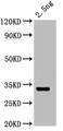 Western Blot, Positive WB detected in: recombinant protein, All lanes: otop1 Antibody at 1:1000, Secondary, Goat polyclonal to rabbit IgG at 1/50000 dilution, Predicted band size: 31 kDa, Observed band size: 31 kDa Western Blot, Positive WB detected in: recombinant protein, All lanes: otop1 Antibody at 1:1000, Secondary, Goat polyclonal to rabbit IgG at 1/50000 dilution, Predicted band size: 31 kDa, Observed band size: 31 kDa