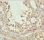 Immunohistochemistry of paraffin-embedded human testis tissue using CAC13395 at dilution of 1:100 Immunohistochemistry of paraffin-embedded human testis tissue using CAC13395 at dilution of 1:100