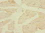 Immunohistochemistry of paraffin-embedded human skeletal muscle tissue using CAC13396 at dilution of 1:100 Immunohistochemistry of paraffin-embedded human skeletal muscle tissue using CAC13396 at dilution of 1:100