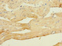 Immunohistochemistry of paraffin-embedded human heart tissue using CAC13396 at dilution of 1:100 Immunohistochemistry of paraffin-embedded human heart tissue using CAC13396 at dilution of 1:100