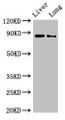 Western Blot, Positive WB detected in: Rat liver tissue, Rat lung tissue, All lanes: DENND1C antibody at 3ug/ml, Secondary, Goat polyclonal to rabbit IgG at 1/50000 dilution, Predicted band size: 88, 83 kDa, Observed band size: 88 kDa Western Blot, Positive WB detected in: Rat liver tissue, Rat lung tissue, All lanes: DENND1C antibody at 3ug/ml, Secondary, Goat polyclonal to rabbit IgG at 1/50000 dilution, Predicted band size: 88, 83 kDa, Observed band size: 88 kDa
