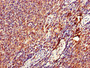 Immunohistochemistry of paraffin-embedded human lymph node tissue using CAC13398 at dilution of 1:100 Immunohistochemistry of paraffin-embedded human lymph node tissue using CAC13398 at dilution of 1:100