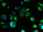 Immunofluorescent analysis of MCF-7 cells using CAC13411 at dilution of 1:100 and Alexa Fluor 488-congugated AffiniPure Goat Anti-Rabbit IgG(H+L) Immunofluorescent analysis of MCF-7 cells using CAC13411 at dilution of 1:100 and Alexa Fluor 488-congugated AffiniPure Goat Anti-Rabbit IgG(H+L)