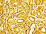 IHC image of CAC13413 diluted at 1:300 and staining in paraffin-embedded human kidney tissue performed on a Leica BondTM system. After dewaxing and hydration, antigen retrieval was mediated by high pressure in a citrate buffer (pH 6.0). Section was blocked with 10% normal goat serum 30min at RT. Then primary antibody (1% BSA) was incubated at 4°C overnight. The primary is detected by a biotinylated secondary antibody and visualized using an HRP conjugated SP system. IHC image of CAC13413 diluted at 1:300 and staining in paraffin-embedded human kidney tissue performed on a Leica BondTM system. After dewaxing and hydration, antigen retrieval was mediated by high pressure in a citrate buffer (pH 6.0). Section was blocked with 10% normal goat serum 30min at RT. Then primary antibody (1% BSA) was incubated at 4°C overnight. The primary is detected by a biotinylated secondary antibody and visualized using an HRP conjugated SP system.