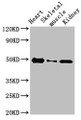 Western Blot, Positive WB detected in: Rat heart tissue, Rat skeletal muscle, Mouse kidney tissue, All lanes: ATP6V1C2 antibody at 3.4ug/ml, Secondary, Goat polyclonal to rabbit IgG at 1/50000 dilution, Predicted band size: 49, 44 kDa, Observed band size: 49 kDa Western Blot, Positive WB detected in: Rat heart tissue, Rat skeletal muscle, Mouse kidney tissue, All lanes: ATP6V1C2 antibody at 3.4ug/ml, Secondary, Goat polyclonal to rabbit IgG at 1/50000 dilution, Predicted band size: 49, 44 kDa, Observed band size: 49 kDa
