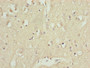 Immunohistochemistry of paraffin-embedded human brain tissue using CAC13419 at dilution of 1:100 Immunohistochemistry of paraffin-embedded human brain tissue using CAC13419 at dilution of 1:100
