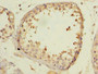 Immunohistochemistry of paraffin-embedded human testis tissue using CAC13425 at dilution of 1:100 Immunohistochemistry of paraffin-embedded human testis tissue using CAC13425 at dilution of 1:100