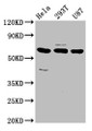 Western Blot, Positive WB detected in: Hela whole cell lysate, 293T whole cell lysate, U87 whole cell lysate, All lanes: NETO1 antibody at 3.2ug/ml, Secondary, Goat polyclonal to rabbit IgG at 1/50000 dilution, Predicted band size: 61, 18 kDa, Observed band size: 61 kDa Western Blot, Positive WB detected in: Hela whole cell lysate, 293T whole cell lysate, U87 whole cell lysate, All lanes: NETO1 antibody at 3.2ug/ml, Secondary, Goat polyclonal to rabbit IgG at 1/50000 dilution, Predicted band size: 61, 18 kDa, Observed band size: 61 kDa