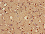 Immunohistochemistry of paraffin-embedded human brain tissue using CAC13437 at dilution of 1:100
