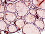 Immunohistochemistry of paraffin-embedded human thyroid tissue using CAC13454 at dilution of 1:100 Immunohistochemistry of paraffin-embedded human thyroid tissue using CAC13454 at dilution of 1:100