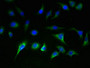 Immunofluorescent analysis of A549 cells using CAC13455 at dilution of 1:100 and Alexa Fluor 488-congugated AffiniPure Goat Anti-Rabbit IgG(H+L) Immunofluorescent analysis of A549 cells using CAC13455 at dilution of 1:100 and Alexa Fluor 488-congugated AffiniPure Goat Anti-Rabbit IgG(H+L)
