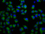 Immunofluorescence staining of Hela cells with CAC13456 at 1:133, counter-stained with DAPI. The cells were fixed in 4% formaldehyde, permeabilized using 0.2% Triton X-100 and blocked in 10% normal Goat Serum. The cells were then incubated with the antibody overnight at 4°C. The secondary antibody was Alexa Fluor 488-congugated AffiniPure Goat Anti-Rabbit IgG(H+L). Immunofluorescence staining of Hela cells with CAC13456 at 1:133, counter-stained with DAPI. The cells were fixed in 4% formaldehyde, permeabilized using 0.2% Triton X-100 and blocked in 10% normal Goat Serum. The cells were then incubated with the antibody overnight at 4°C. The secondary antibody was Alexa Fluor 488-congugated AffiniPure Goat Anti-Rabbit IgG(H+L).