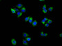 Immunofluorescence staining of Hela cells with CAC13457 at 1:100, counter-stained with DAPI. The cells were fixed in 4% formaldehyde, permeabilized using 0.2% Triton X-100 and blocked in 10% normal Goat Serum. The cells were then incubated with the antibody overnight at 4°C. The secondary antibody was Alexa Fluor 488-congugated AffiniPure Goat Anti-Rabbit IgG(H+L). Immunofluorescence staining of Hela cells with CAC13457 at 1:100, counter-stained with DAPI. The cells were fixed in 4% formaldehyde, permeabilized using 0.2% Triton X-100 and blocked in 10% normal Goat Serum. The cells were then incubated with the antibody overnight at 4°C. The secondary antibody was Alexa Fluor 488-congugated AffiniPure Goat Anti-Rabbit IgG(H+L).
