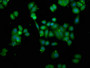 Immunofluorescence staining of PC-3 cells with CAC13458 at 1:166, counter-stained with DAPI. The cells were fixed in 4% formaldehyde, permeabilized using 0.2% Triton X-100 and blocked in 10% normal Goat Serum. The cells were then incubated with the antibody overnight at 4°C. The secondary antibody was Alexa Fluor 488-congugated AffiniPure Goat Anti-Rabbit IgG(H+L). Immunofluorescence staining of PC-3 cells with CAC13458 at 1:166, counter-stained with DAPI. The cells were fixed in 4% formaldehyde, permeabilized using 0.2% Triton X-100 and blocked in 10% normal Goat Serum. The cells were then incubated with the antibody overnight at 4°C. The secondary antibody was Alexa Fluor 488-congugated AffiniPure Goat Anti-Rabbit IgG(H+L).