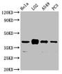 Western Blot, Positive WB detected in: Hela whole cell lysate, LO2 whole cell lysate, A549 whole cell lysate, PC-3 whole cell lysate, All lanes: VN1R1 antibody at 3.3ug/ml, Secondary, Goat polyclonal to rabbit IgG at 1/50000 dilution, Predicted band size: 41 kDa, Observed band size: 41 kDa Western Blot, Positive WB detected in: Hela whole cell lysate, LO2 whole cell lysate, A549 whole cell lysate, PC-3 whole cell lysate, All lanes: VN1R1 antibody at 3.3ug/ml, Secondary, Goat polyclonal to rabbit IgG at 1/50000 dilution, Predicted band size: 41 kDa, Observed band size: 41 kDa