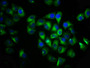 Immunofluorescence staining of Hela cells with CAC13467 at 1:133, counter-stained with DAPI. The cells were fixed in 4% formaldehyde, permeabilized using 0.2% Triton X-100 and blocked in 10% normal Goat Serum. The cells were then incubated with the antibody overnight at 4°C. The secondary antibody was Alexa Fluor 488-congugated AffiniPure Goat Anti-Rabbit IgG(H+L). Immunofluorescence staining of Hela cells with CAC13467 at 1:133, counter-stained with DAPI. The cells were fixed in 4% formaldehyde, permeabilized using 0.2% Triton X-100 and blocked in 10% normal Goat Serum. The cells were then incubated with the antibody overnight at 4°C. The secondary antibody was Alexa Fluor 488-congugated AffiniPure Goat Anti-Rabbit IgG(H+L).