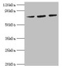 Western Blot, All lanes: HSPA6 antibody at 2ug/ml, Lane 1: MCF-7 whole cell lysate, Lane 2: A431 whole cell lysate, Lane 3: Jurkat whole cell lysate, Secondary, Goat polyclonal to rabbit IgG at 1/10000 dilution, Predicted band size: 72 kDa, Observed band size: 72 kDa Western Blot, All lanes: HSPA6 antibody at 2ug/ml, Lane 1: MCF-7 whole cell lysate, Lane 2: A431 whole cell lysate, Lane 3: Jurkat whole cell lysate, Secondary, Goat polyclonal to rabbit IgG at 1/10000 dilution, Predicted band size: 72 kDa, Observed band size: 72 kDa