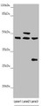 Western Blot, All lanes: HAUS8 antibody at 2.35 ug/ml, Lane 1: Mouse kidney tissue, Lane 2: Mouse brain tissue, Lane 3: A549 whole cell lysate, Secondary, Goat polyclonal to rabbit IgG at 1/10000 dilution, Predicted band size: 45, 39 kDa, Observed band size: 45, 50, 28 kDa