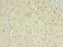 Immunohistochemistry of paraffin-embedded human liver tissue using CAC13480 at dilution of 1:100