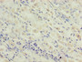 Immunohistochemistry of paraffin-embedded human gastric cancer using CAC13481 at dilution of 1:100