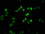 Immunofluorescence staining of HepG2 cells with CAC13491 at 1:100, counter-stained with DAPI. The cells were fixed in 4% formaldehyde, permeabilized tissue using 0.2% Triton X-100 and blocked in 10% normal Goat Serum. The cells were then incubated with the antibody overnight at 4°C.The secondary antibody was Alexa Fluor 488-congugated AffiniPure Goat Anti-Rabbit IgG(H+L). Immunofluorescence staining of HepG2 cells with CAC13491 at 1:100, counter-stained with DAPI. The cells were fixed in 4% formaldehyde, permeabilized tissue using 0.2% Triton X-100 and blocked in 10% normal Goat Serum. The cells were then incubated with the antibody overnight at 4°C.The secondary antibody was Alexa Fluor 488-congugated AffiniPure Goat Anti-Rabbit IgG(H+L).