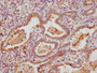 IHC image of CAC13496 diluted at 1:300 and staining in paraffin-embedded human lung tissue performed on a Leica BondTM system. After dewaxing and hydration, antigen retrieval was mediated by high pressure in a citrate buffer (pH 6.0). Section was blocked with 10% normal goat serum 30min at RT. Then primary antibody (1% BSA) was incubated at 4°C overnight. The primary is detected by a Goat anti-rabbit polymer IgG labeled by HRP and visualized using 0.05% DAB.