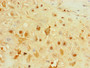 Immunohistochemistry of paraffin-embedded human placenta tissue using CAC13506 at dilution of 1:100 Immunohistochemistry of paraffin-embedded human placenta tissue using CAC13506 at dilution of 1:100