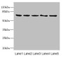 Western Blot, All lanes: PLK3 antibody at 1.2ug/ml, Lane 1: Rat heart tissue, Lane 2: Hela whole cell lysate, Lane 3: 293T whole cell lysate, Lane 4: MCF-7 whole cell lysate, Lane 5: Monocytic leukemia cells in mice Macrophages, Secondary, Goat polyclonal to rabbit IgG at 1/10000 dilution, Predicted band size: 72 kDa, Observed band size: 72 kDa Western Blot, All lanes: PLK3 antibody at 1.2ug/ml, Lane 1: Rat heart tissue, Lane 2: Hela whole cell lysate, Lane 3: 293T whole cell lysate, Lane 4: MCF-7 whole cell lysate, Lane 5: Monocytic leukemia cells in mice Macrophages, Secondary, Goat polyclonal to rabbit IgG at 1/10000 dilution, Predicted band size: 72 kDa, Observed band size: 72 kDa