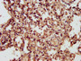 IHC image of CAC13513 diluted at 1:300 and staining in paraffin-embedded human lung tissue performed on a Leica BondTM system. After dewaxing and hydration, antigen retrieval was mediated by high pressure in a citrate buffer (pH 6.0). Section was blocked with 10% normal goat serum 30min at RT. Then primary antibody (1% BSA) was incubated at 4°C overnight. The primary is detected by a biotinylated secondary antibody and visualized using an HRP conjugated SP system.