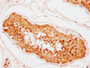 IHC image of CAC13523 diluted at 1:400 and staining in paraffin-embedded human testis tissue performed on a Leica BondTM system. After dewaxing and hydration, antigen retrieval was mediated by high pressure in a citrate buffer (pH 6.0). Section was blocked with 10% normal goat serum 30min at RT. Then primary antibody (1% BSA) was incubated at 4°C overnight. The primary is detected by a biotinylated secondary antibody and visualized using an HRP conjugated SP system. IHC image of CAC13523 diluted at 1:400 and staining in paraffin-embedded human testis tissue performed on a Leica BondTM system. After dewaxing and hydration, antigen retrieval was mediated by high pressure in a citrate buffer (pH 6.0). Section was blocked with 10% normal goat serum 30min at RT. Then primary antibody (1% BSA) was incubated at 4°C overnight. The primary is detected by a biotinylated secondary antibody and visualized using an HRP conjugated SP system.