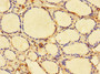 Immunohistochemistry of paraffin-embedded human thyroid tissue using CAC13540 at dilution of 1:100 Immunohistochemistry of paraffin-embedded human thyroid tissue using CAC13540 at dilution of 1:100