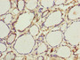 Immunohistochemistry of paraffin-embedded human thyroid tissue using CAC13542 at dilution of 1:100 Immunohistochemistry of paraffin-embedded human thyroid tissue using CAC13542 at dilution of 1:100