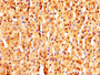 IHC image of CAC13546 diluted at 1:320 and staining in paraffin-embedded human adrenal gland tissue performed on a Leica BondTM system. After dewaxing and hydration, antigen retrieval was mediated by high pressure in a citrate buffer (pH 6.0). Section was blocked with 10% normal goat serum 30min at RT. Then primary antibody (1% BSA) was incubated at 4°C overnight. The primary is detected by a biotinylated secondary antibody and visualized using an HRP conjugated SP system.
