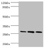 Western Blot, All lanes: ORC6 antibody at 16ug/ml, Lane 1: Mouse spleen tissue, Lane 2: MCF-7 whole cell lysate, Lane 3: Hela whole cell lysate, Secondary, Goat polyclonal to rabbit IgG at 1/10000 dilution, Predicted band size: 28 kDa, Observed band size: 28 kDa