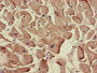 Immunohistochemistry of paraffin-embedded human heart tissue using CAC13550 at dilution of 1:100 Immunohistochemistry of paraffin-embedded human heart tissue using CAC13550 at dilution of 1:100