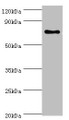 Western Blot, All lanes: SLC27A6 antibody at 4ug/ml + MCF-7 whole cell lysate, Secondary, Goat polyclonal to rabbit IgG at 1/10000 dilution, Predicted band size: 70 kDa, Observed band size: 70 kDa Western Blot, All lanes: SLC27A6 antibody at 4ug/ml + MCF-7 whole cell lysate, Secondary, Goat polyclonal to rabbit IgG at 1/10000 dilution, Predicted band size: 70 kDa, Observed band size: 70 kDa