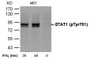 Western blot analysis of extracts from MEF cells untreated or treated with interferon-96 Western blot analysis of extracts from MEF cells untreated or treated with interferon-96